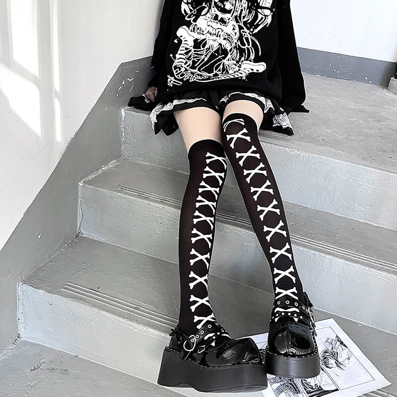 Bones